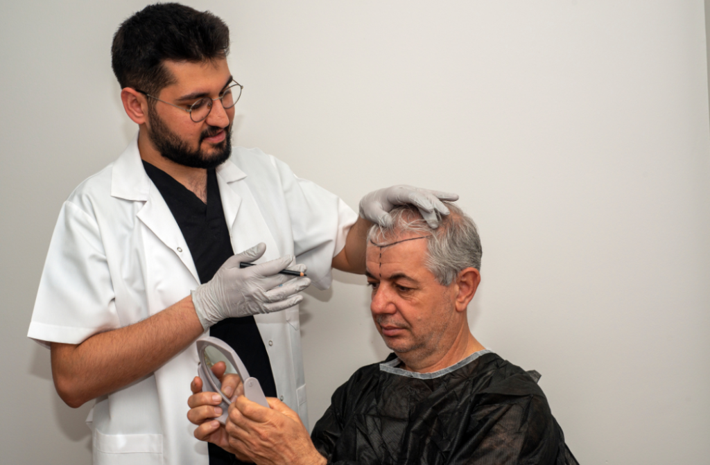 dottori trapianto di capelli