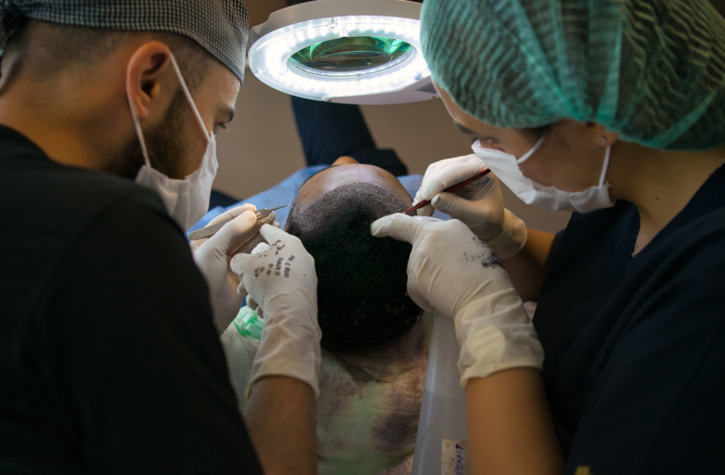tecniche di trapianto di capelli